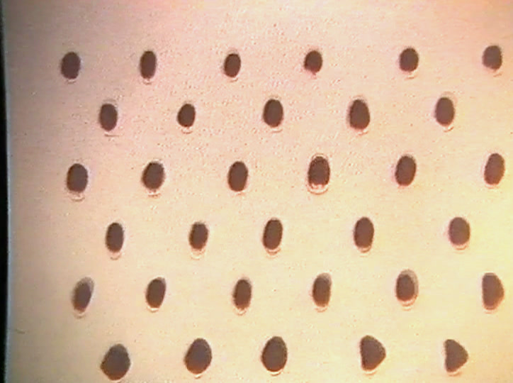 13–19, Kun iho huutaa apua